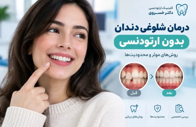 درمان شلوغی دندان بدون ارتودنسی و روش‌های اصلاح نامرتبی دندان