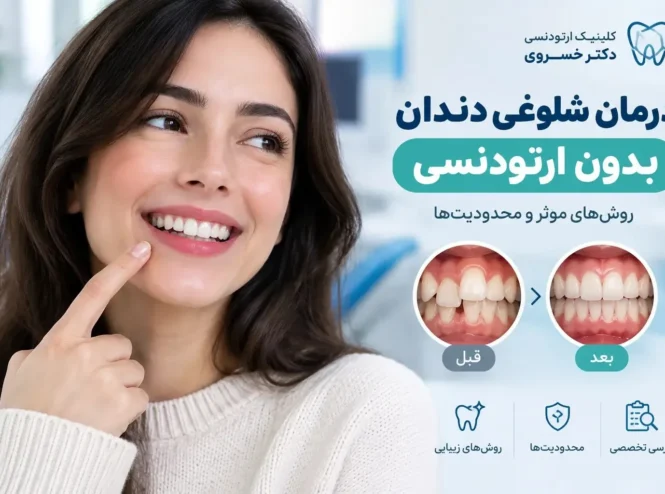 درمان شلوغی دندان بدون ارتودنسی و روش‌های اصلاح نامرتبی دندان