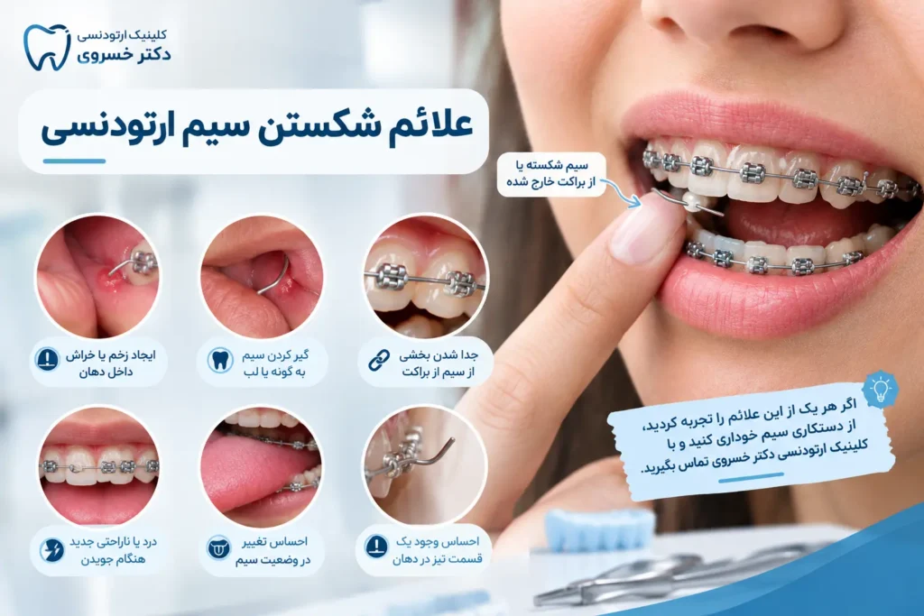 علائم و نشانه های شکستن سیم ارتودنسی