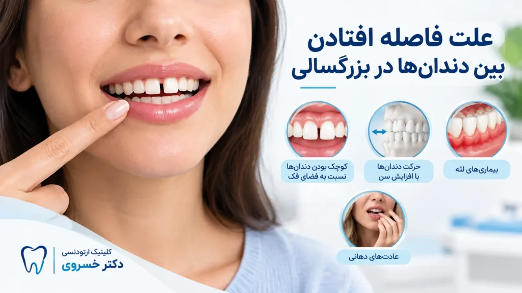 علت فاصله بین دندان‌ها در بزرگسالان
