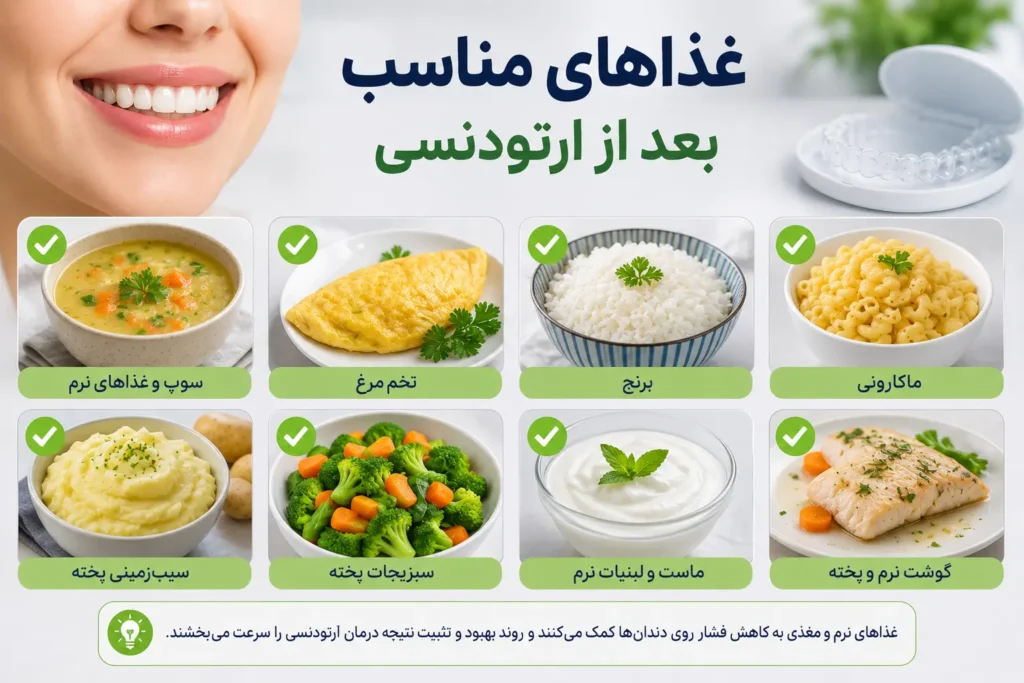 غذاهای مناسب بعد از ارتودنسی