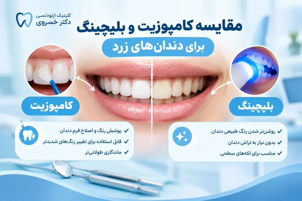تفاوت کامپوزیت و بلیچینگ برای دندان‌های زرد
