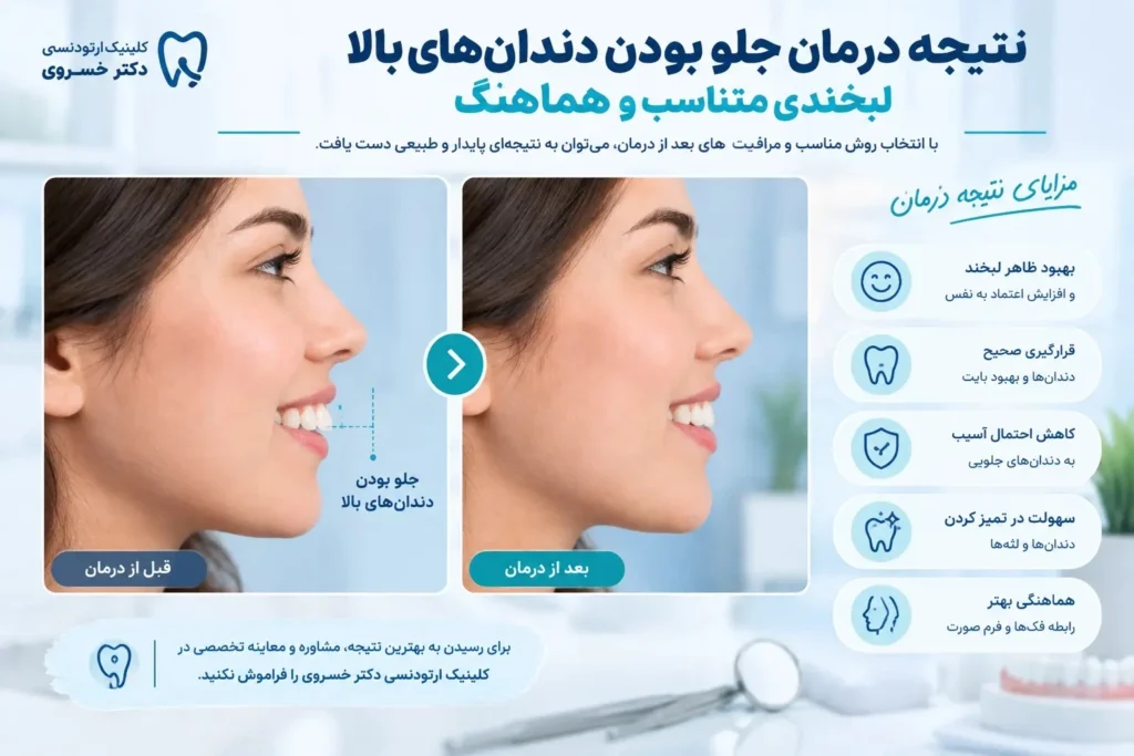 نتیجه درمان جلو بودن دندان های بالا