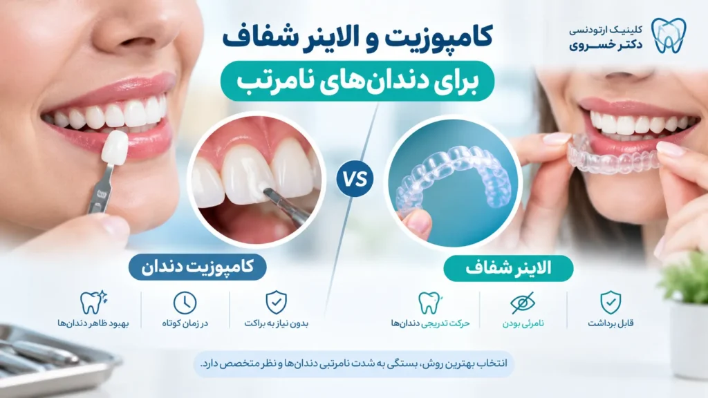 مقایسه اصلاح ظاهری دندان با کامپوزیت و حرکت دندان با الاینر شفاف