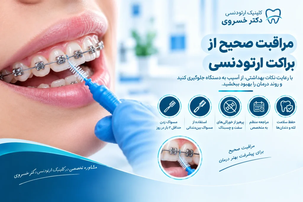 تمیز کردن اطراف براکت ارتودنسی با مسواک بین‌دندانی
