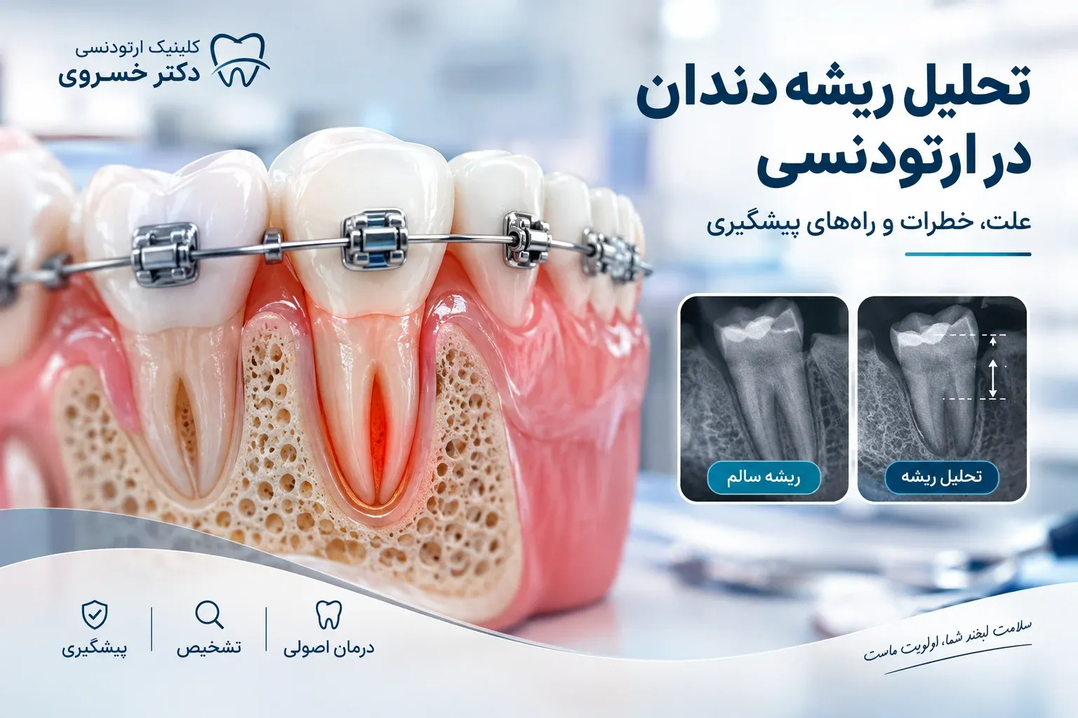 تحلیل ریشه دندان در ارتودنسی