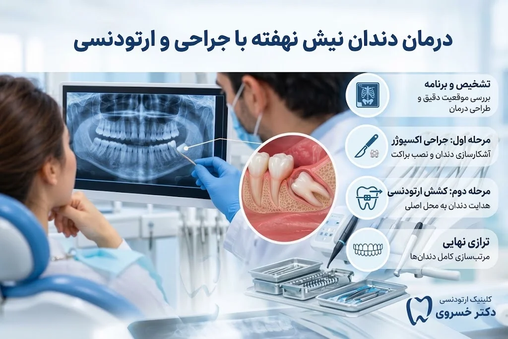 درمان دندان نیش نهفته با جراحی و ارتودنسی