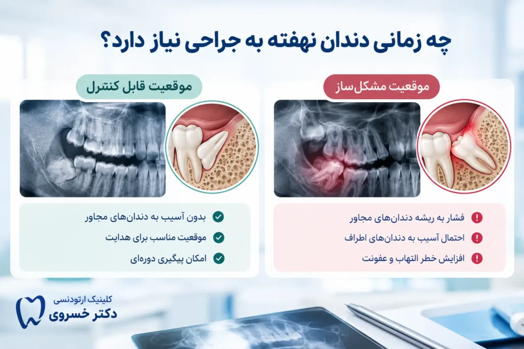 بررسی موقعیت دندان نهفته و نیاز به جراحی
